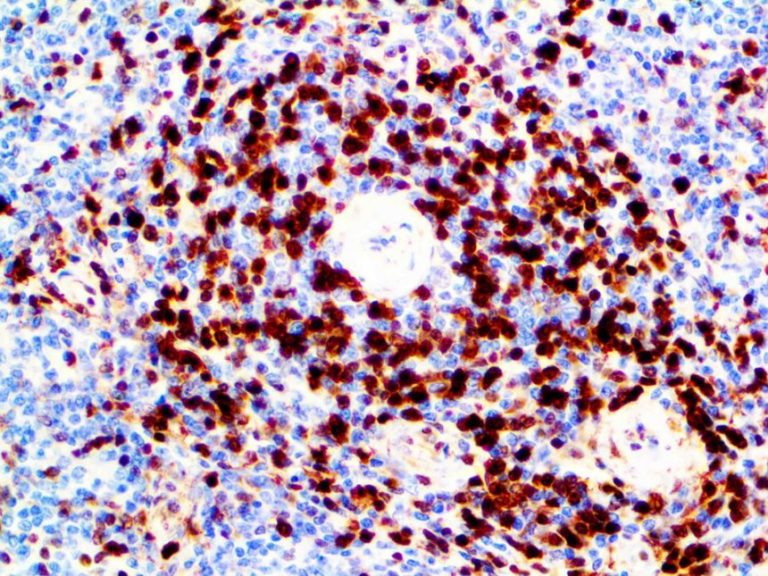 Annexin-a1 - mmab - affordable ihc solutions